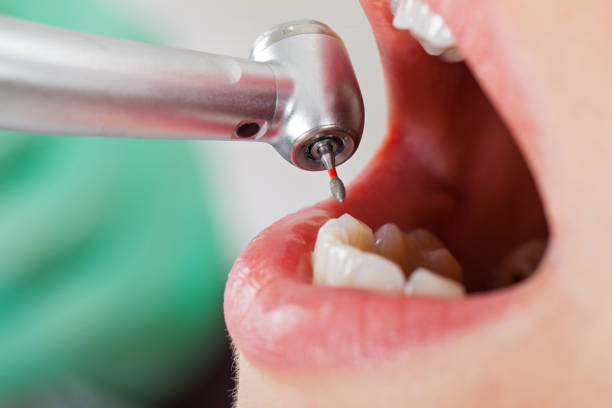 Best Emergency TMJ Treatment in San Diego Country Estates, CA